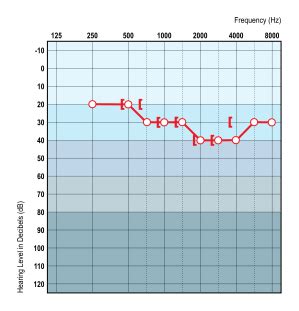 nhl to ehl correction|LM 212: Hearing Aids for Babies: Predicting Audiograms from.